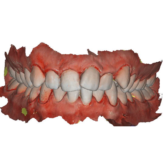 کراودینگ های دندانی - لابراتوار اتیوس